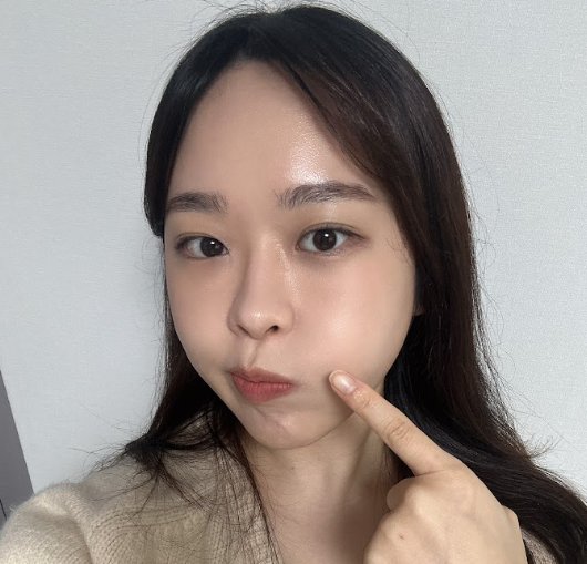 청주피부과, 요즘 유행한다는 스킨부스터 ㄱㅇㄹ?